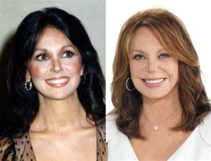 Marlo Thomas Plastic Surgery Before and After Facelift Star Plastic