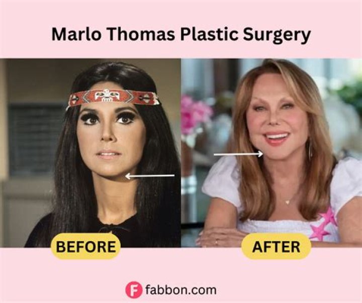 Marlo Thomas Plastic Surgery Diversity News Magazine Celebrity