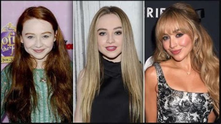 Sabrina Carpenter Plastic Surgery Botox And Lip Filler